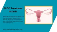 PCOD Treatment in Delhi